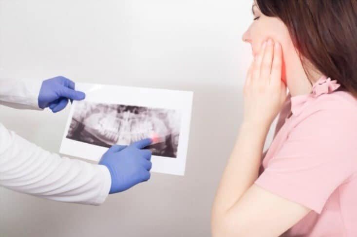 Wisdom Teeth Removal: Important things to Know?