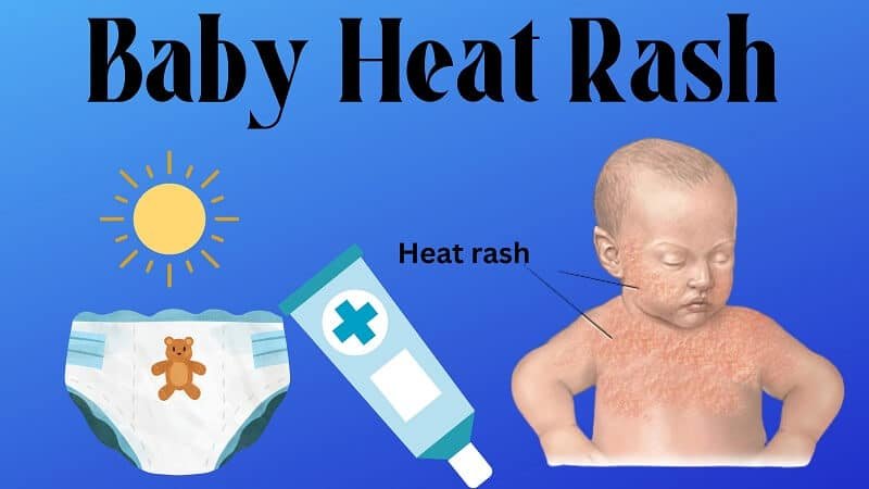 Baby Heat Rash