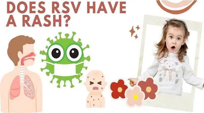 Does RSV Have A Rash